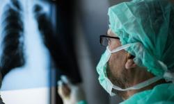 istock-1214743843-lung-cancer