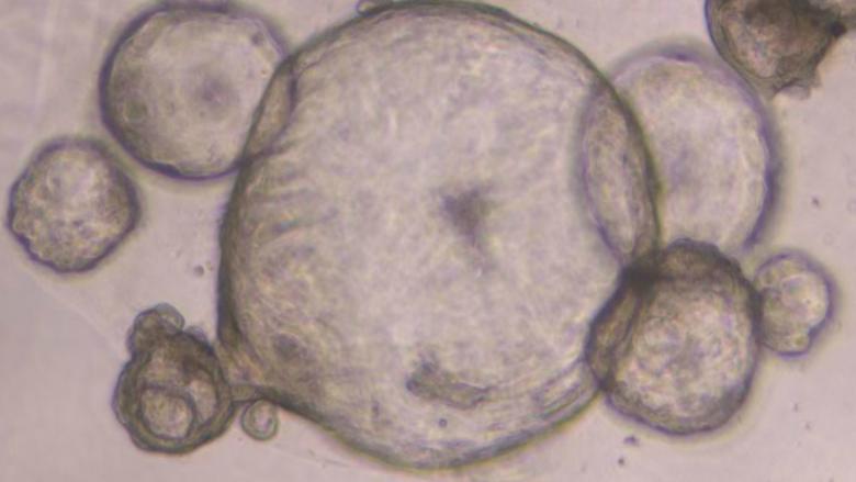 The pancreatic organoids, as viewed under magnification