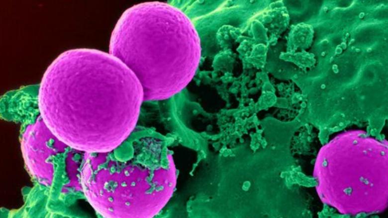Dr Alex Eustace and Colleagues Trial Potential New Treatment for Breast Cancer