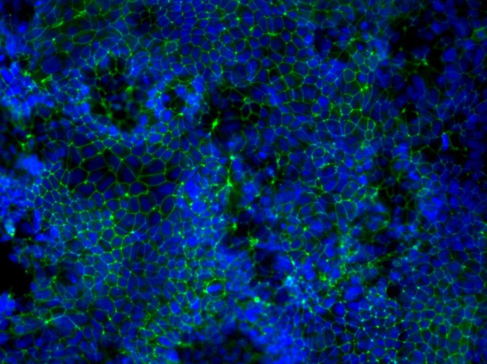 Immunofluorescent images of cornea epithelial cells