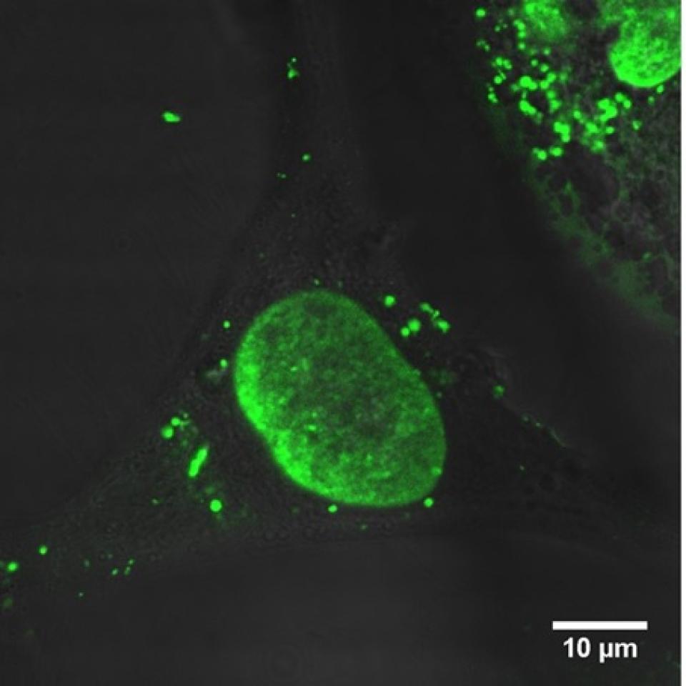 Live HeLa cells stained Ruthenium bioconjugate (green)