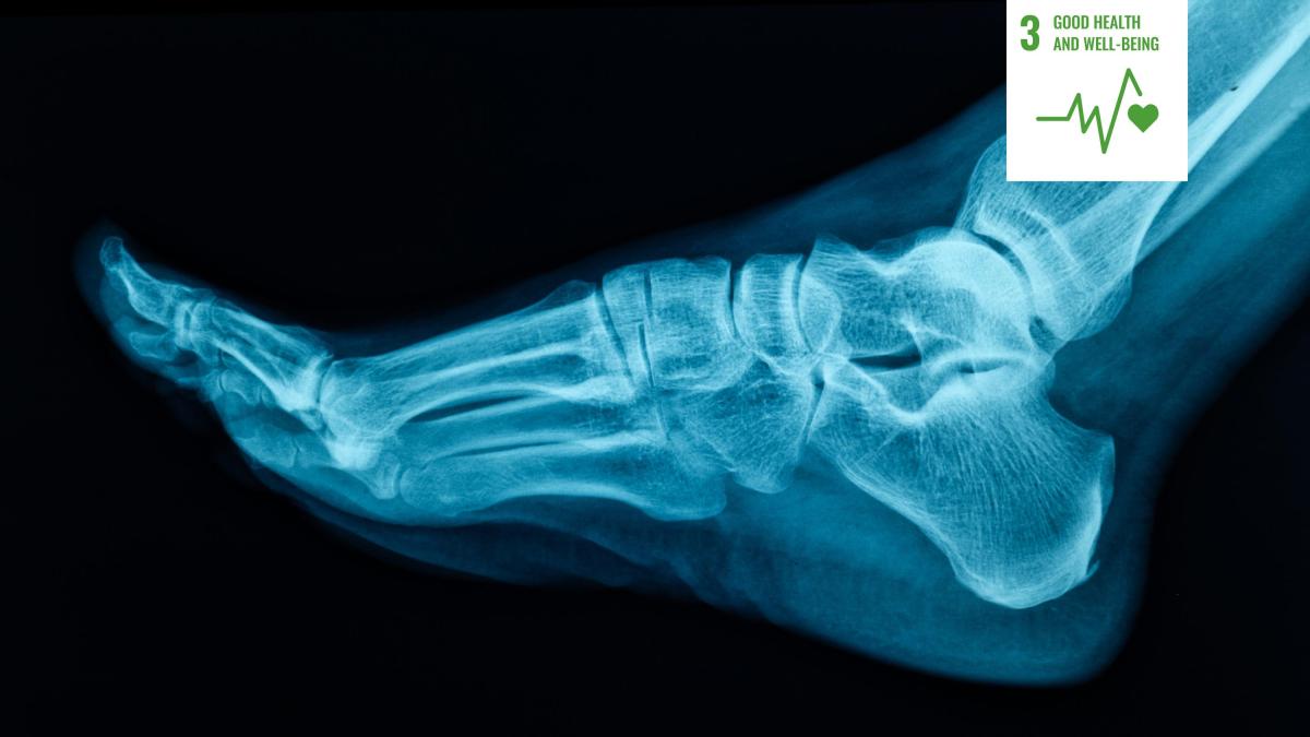Shows x-ray of foot with bones visible