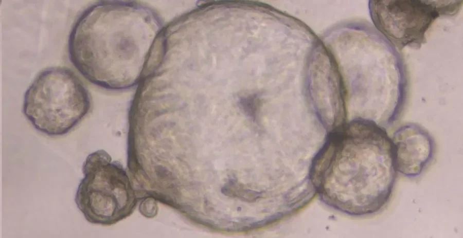 The pancreatic organoids, as viewed under magnification
