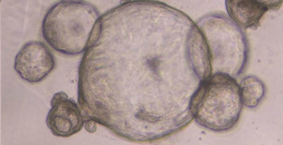 The pancreatic organoids, as viewed under magnification