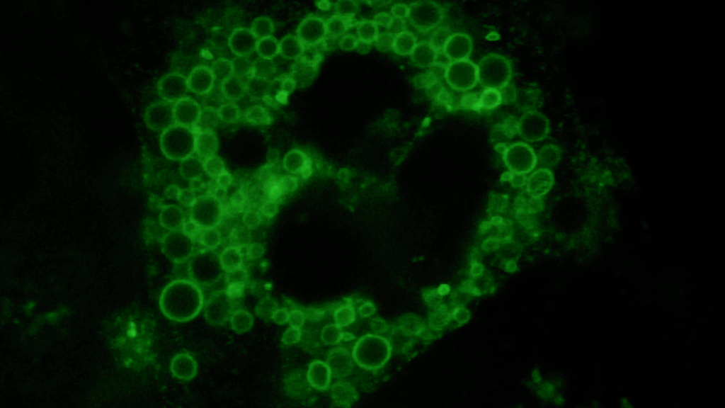 Fluorescence image of cell Lysosome