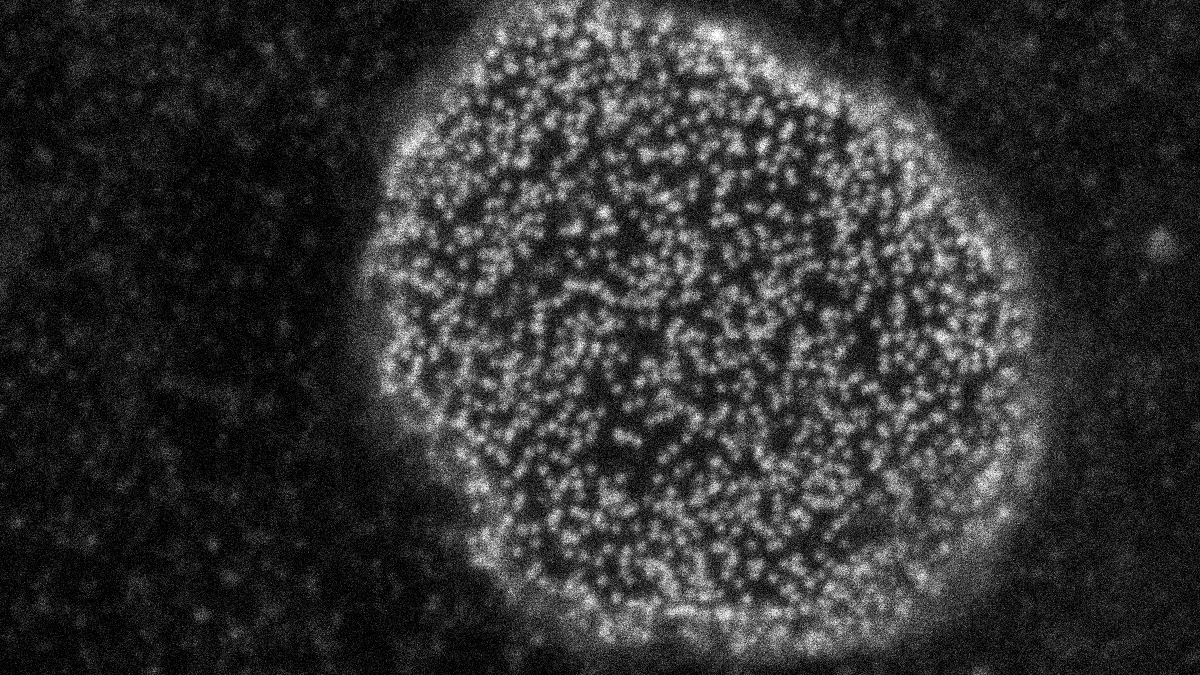 Super Resolution Image of nuclear pores